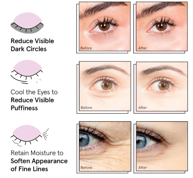 Under Eye Masks for Puffy Eyes, Dark Circles by Grace & Stella -