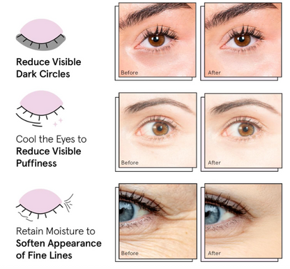 Under Eye Masks for Puffy Eyes, Dark Circles by Grace & Stella -